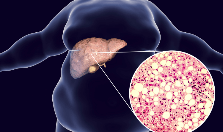 What You Need to Know About Liver Cancer Treatment in Malaysia?